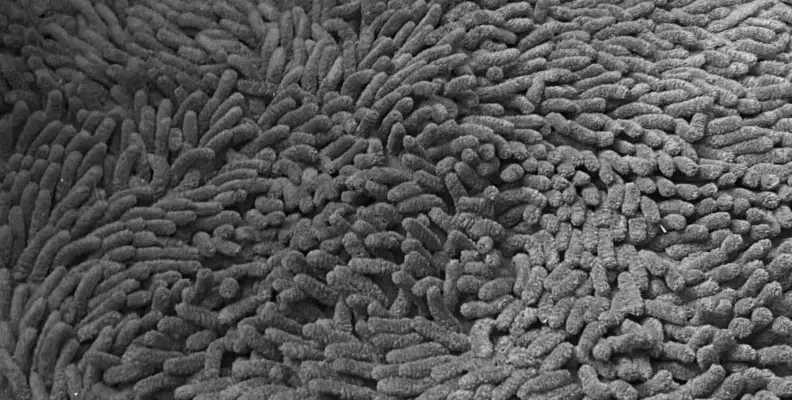 hali kabartma yontemi